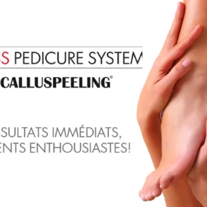 Calluspeeling de Mavex